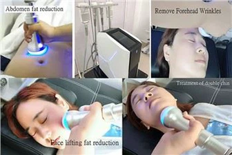 Unieke voordelen van Amerika's best verkopende Cryoskin-machine