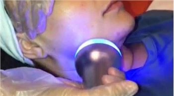 Cryoslimming Machine