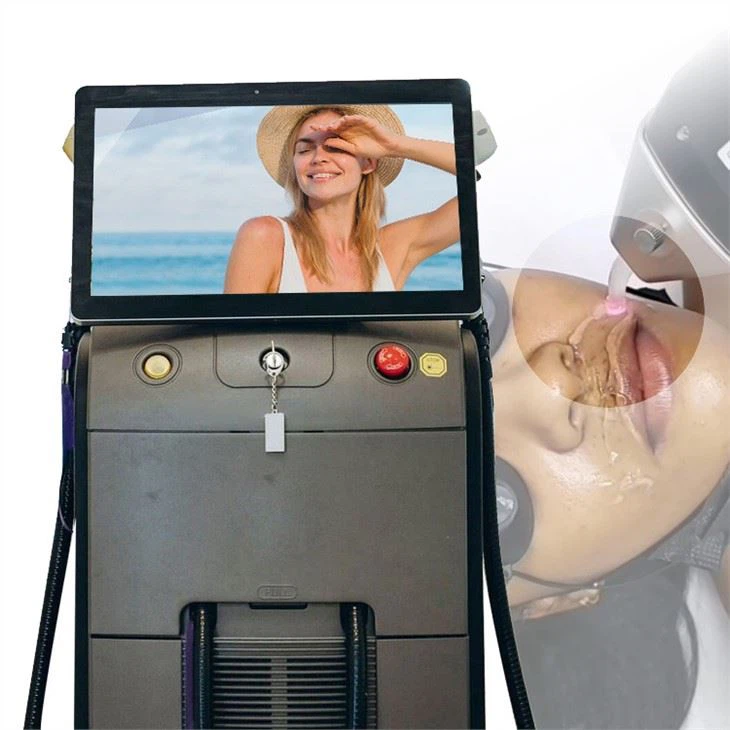 Soprano Ice Titanium, A Hair Removal Machine That Will Be Popular in The US in 2022
