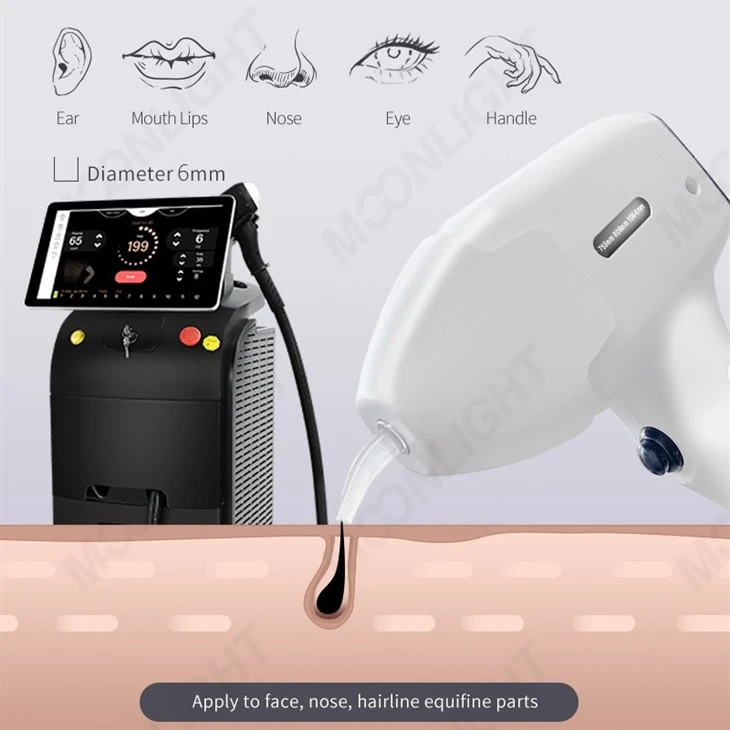Diode Laser Hair Removal Machine Good Reviews
