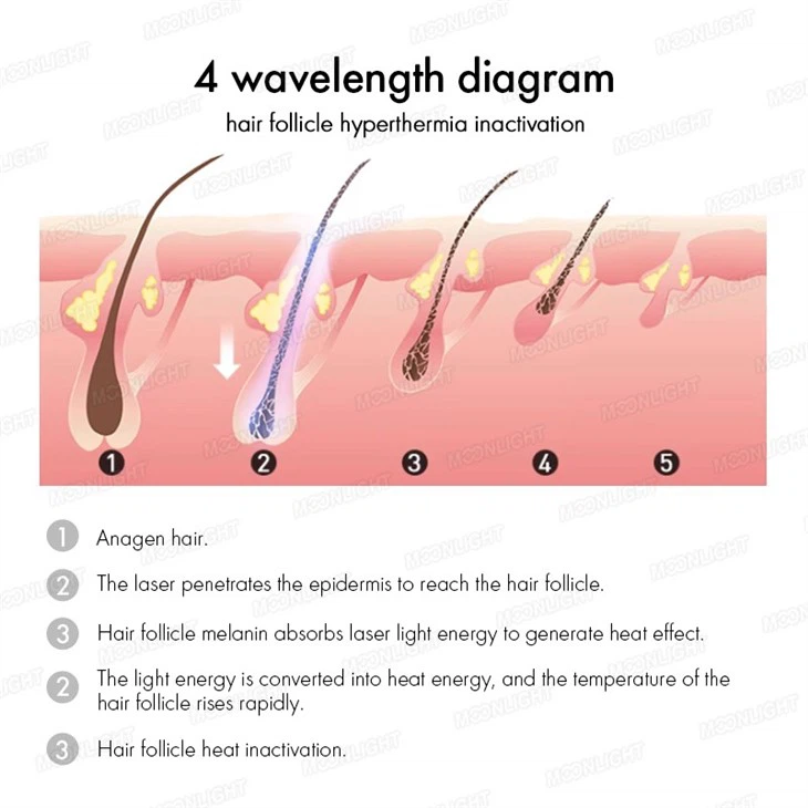 Smarter Diode Laser Hair Removal Machine