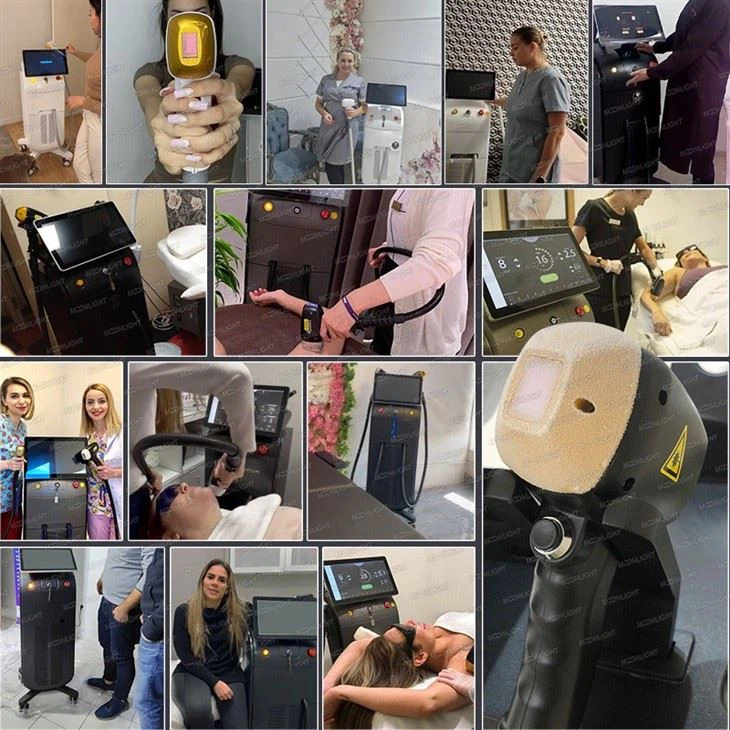 Smarter Diode Laser Hair Removal Machine
