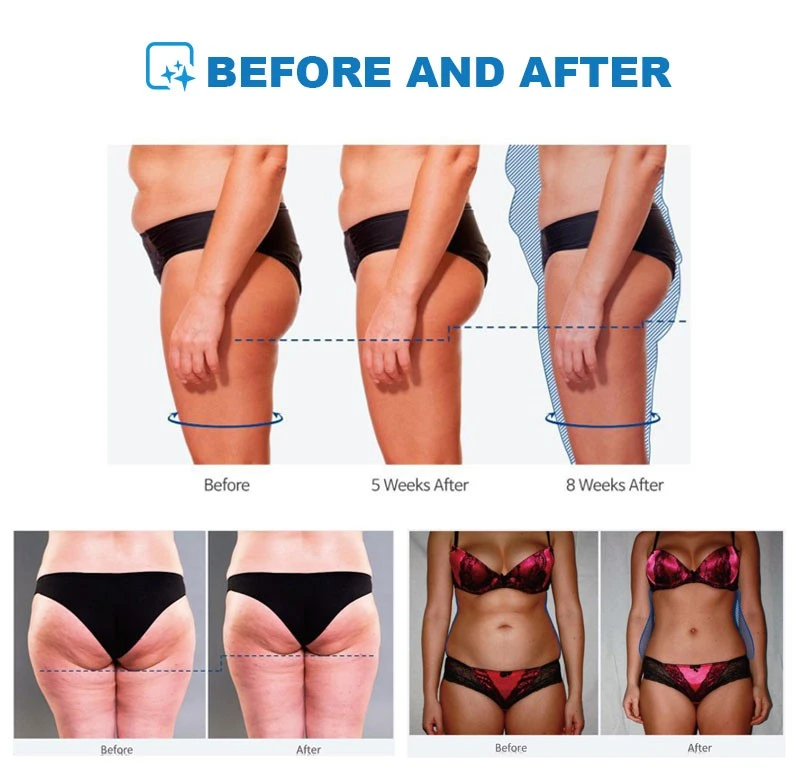Portable EMSculpt Machine – Build Muscle & Burn Fat Anytime, Anywhere price